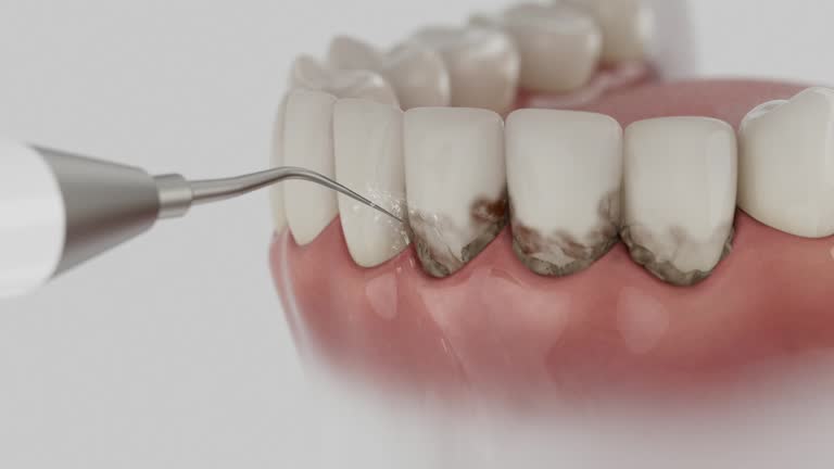 Trusted Wisdom Tooth Removal service in Ixonia, WI - Dentist Open Now